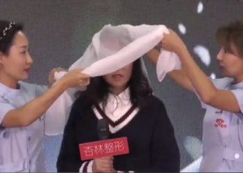 Dukej si plakë si pasojë e sëmundjes së rrallë: 15-vjeçarja i habit të gjithë me pamjen e re (Foto)