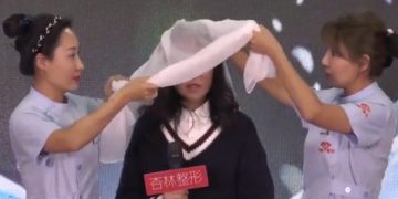 Dukej si plakë si pasojë e sëmundjes së rrallë: 15-vjeçarja i habit të gjithë me pamjen e re (Foto)