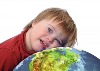 Sindroma down mund të shërohet? Një studim i ri jep shpresa