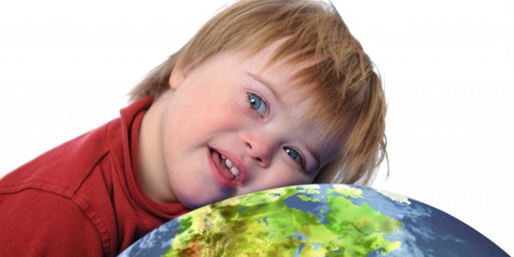 Sindroma down mund të shërohet? Një studim i ri jep shpresa