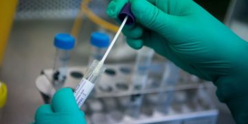 Pandemia e koronavirusit, Gjermania gati për testin e madh kombëtar