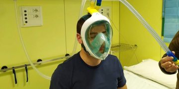 Inxhinierët italianë prodhojnë ventilatorë 3D për t’u ardhur në ndihmë spitaleve