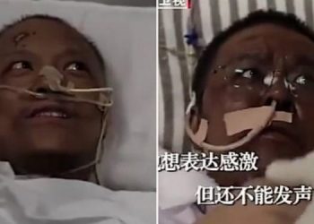 Covid-19, të infektuar nga koronavirusi, dy mjekëve kinezë u ndryshoi ngjyra e lëkurës