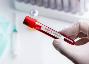 Në kohë pandemie vjen lajmi i mirë, Serbia do të bëjë gjestin bujar ndaj Kosovës