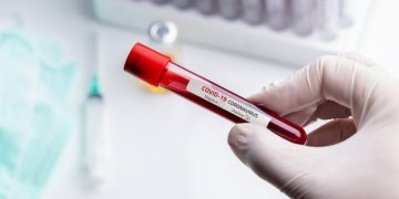 Në kohë pandemie vjen lajmi i mirë, Serbia do të bëjë gjestin bujar ndaj Kosovës