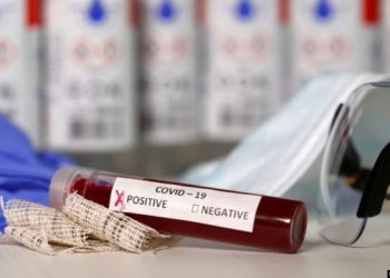 COVID-19, Italia me “pasaporta imuniteti”