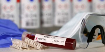 COVID-19, Italia me “pasaporta imuniteti”