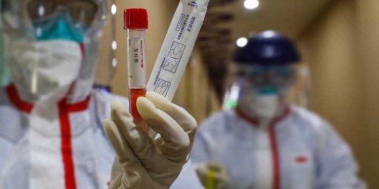 Studimi në Itali: Koronavirus fshihet në lotët e të sëmurëve edhe pasi pacienti është testuar negativ