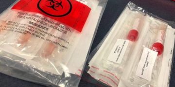 Mjeku i njohur: Do të bëjmë teste, fillimisht për policët e punonjësit e ushtrisë. Do shkëpusim totalisht zinxhirin e infeksionit!