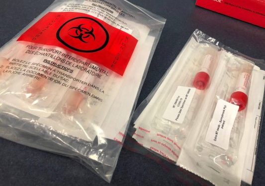 Doktorë dhe infermierë kritikojnë përgjigjien e qeverisë greke për COVID-19