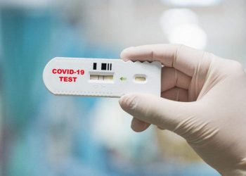 Tregon imunitetin ndaj COVID-19, pret miratimin testimi i shpejtë që mund të na nxjerrë jashtë karantinës