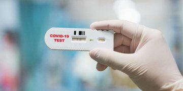 Tregon imunitetin ndaj COVID-19, pret miratimin testimi i shpejtë që mund të na nxjerrë jashtë karantinës