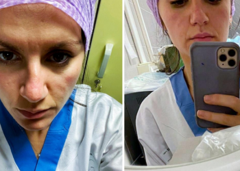 I thanë se ishte maroken, por rezultoi shqiptar: Infermierja rrëfen episodin që e bëri të pendohej pse foli italisht