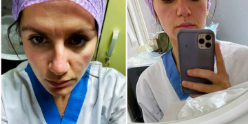 I thanë se ishte maroken, por rezultoi shqiptar: Infermierja rrëfen episodin që e bëri të pendohej pse foli italisht