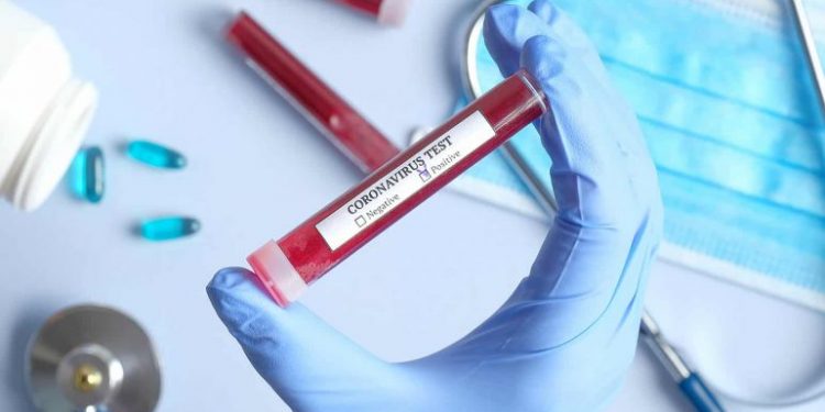 A është vaksina e zbuluar një shekull më parë, “çelësi” për tu përballur me koronavirusin?