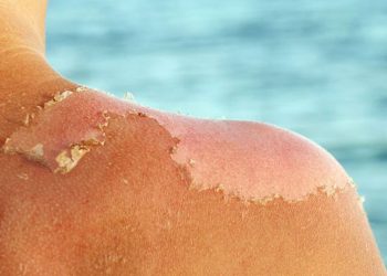 Temperatura deri 40 gradë në Ballkan… Na pret një verë e nxehtë