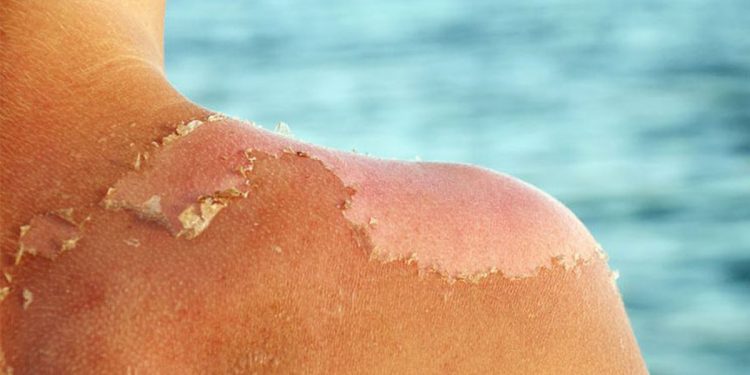 Temperatura deri 40 gradë në Ballkan… Na pret një verë e nxehtë