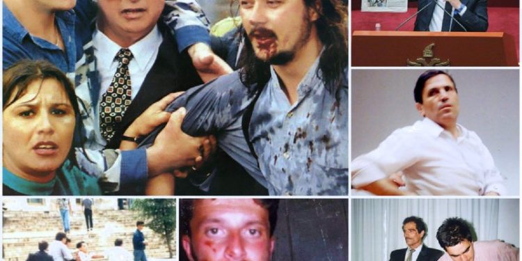 Braçe, Dokle e Servet Pëllumbi me fytyrë të gjakosur, Rama publikon fotot: “Kjo kohë ishte fashizëm!”