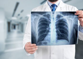 Pacientët e shëruar nga Covid-19 do të kenë probleme me frymëmarrjen dhe plagë të parikuperueshme në mushkëri