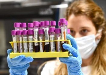 COVID-19: Sa të sakta janë testet që përdoren në SHBA?