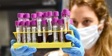 COVID-19: Sa të sakta janë testet që përdoren në SHBA?