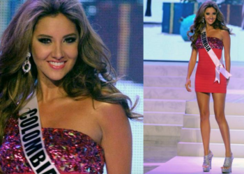 E dhimbshme! Ish-Miss Universi humbet këmbën gjatë komplikacioneve në operacion