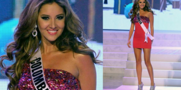 E dhimbshme! Ish-Miss Universi humbet këmbën gjatë komplikacioneve në operacion