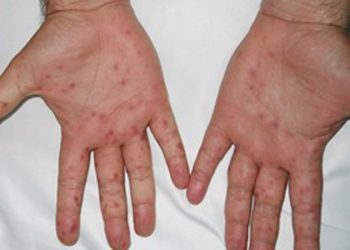 Tritan Kalo nxjerr pamjet e rënda: Mos u fokusoni vetëm te Covid-19, ka shumë infeksione…