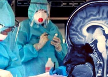 Covid-19 mund të shkaktojë dëmtime të rënda në tru edhe për ata që e kalojnë me simptoma më të lehta