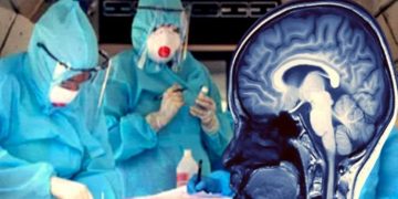 Covid-19 mund të shkaktojë dëmtime të rënda në tru edhe për ata që e kalojnë me simptoma më të lehta