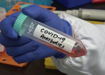 Planifikojnë të prodhojnë 30 milion doza të vaksinës kundër COVID-19, shkencëtarët rus: Vaksina e sigurtë