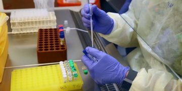 Studimi, testet e Covid-19 nuk janë aspak efektive: Ja pse shumë persona rezultojnë pozitivë pa pasur virusin!