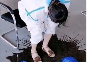 Infermierja përlot botën/ Djersa derdhet “lumë”, pas një turni sfilitës me pacientët e infektuar me Covid-19