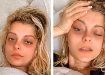 Këngëtarja shiptare Bebe Rexha do t’i nënshtrohet operacionit: Vështirësi në frymëmarrje dhe dhimbje të forta prej 10 ditësh
