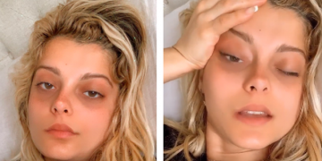 Këngëtarja shiptare Bebe Rexha do t’i nënshtrohet operacionit: Vështirësi në frymëmarrje dhe dhimbje të forta prej 10 ditësh