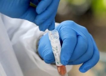 2 viktima dhe 108 raste të reja me COVID-19 në Maqedoninë Veriore