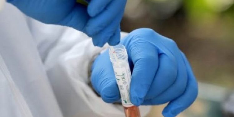 2 viktima dhe 108 raste të reja me COVID-19 në Maqedoninë Veriore