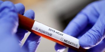 Bilanci i Covid 19/ Humbin jetën katër pacientë në dy spitale, 133 të infektuar në 24 orë (VIDEO)