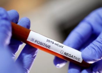 Shifra në rritje, 3,398 raste aktive me COVID-19 në Kosovë, 498 të vdekur