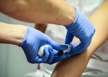 STUDIMI: Ka prekur rreth 50 milionë njerëz në botë, Alcajmeri mund të zbulohet përmes një analize të gjakut