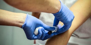 STUDIMI: Ka prekur rreth 50 milionë njerëz në botë, Alcajmeri mund të zbulohet përmes një analize të gjakut