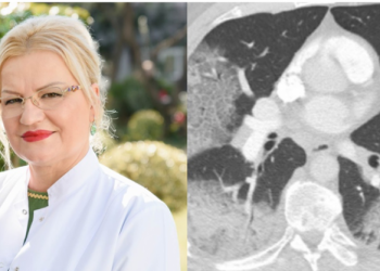 Mjekja shpërthen kundër teoricienëve konspirativë: Palaço që helmojnë miletin, lutuni për frymë kur të vini në spital në dorë të mjekëve