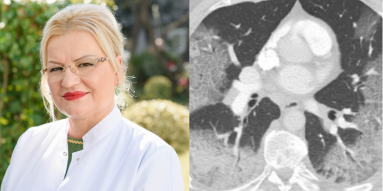 Mjekja shpërthen kundër teoricienëve konspirativë: Palaço që helmojnë miletin, lutuni për frymë kur të vini në spital në dorë të mjekëve