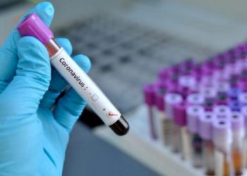 Dekreti i fundit nga Italia: Tampon falas për të gjithë shqiptarët, ja 4 vendet që iu kufizohet lëvizja