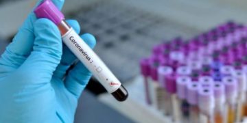 Dekreti i fundit nga Italia: Tampon falas për të gjithë shqiptarët, ja 4 vendet që iu kufizohet lëvizja