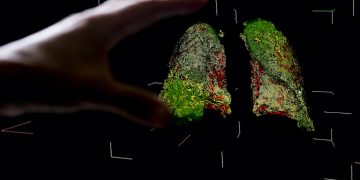 Publikohet studimi më i fundit i koronavirusit: A mund të infektohemi pasi e kemi kaluar Covid-19