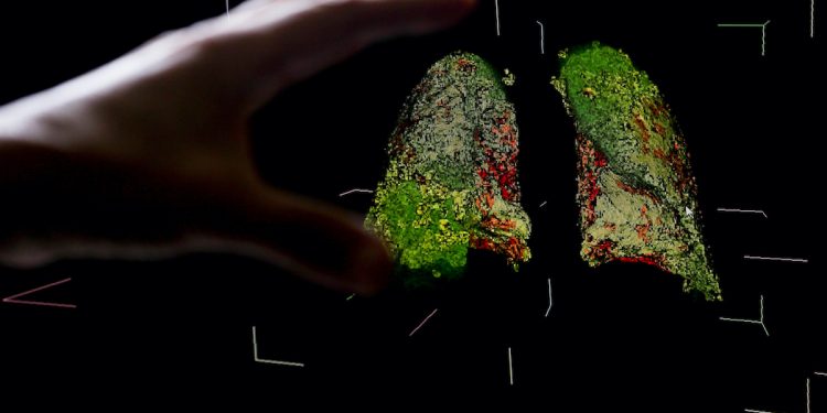 Publikohet studimi më i fundit i koronavirusit: A mund të infektohemi pasi e kemi kaluar Covid-19