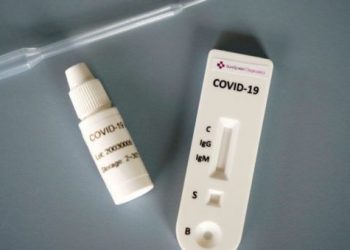 “Çudira shqiptare”, laboratori në Koplik sfidon mjekësinë botërore: Teste për Covid në 10 minuta për 700 lekë