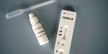 “Çudira shqiptare”, laboratori në Koplik sfidon mjekësinë botërore: Teste për Covid në 10 minuta për 700 lekë