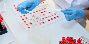 Këto janë grupet e gjakut më rezistentë ndaj Covid-19